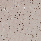 Immunohistochemical staining of human cerebral cortex shows moderate to strong nuclear positivity in neurons.