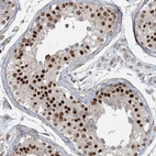 Immunohistochemical staining of human testis shows moderate to strong nuclear positivity in cells in seminiferous ducts.