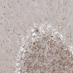 Immunohistochemical staining of human cerebellum shows moderate to strong nuclear positivity in Purkinje cells.