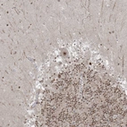 Immunohistochemical staining of human cerebellum shows moderate to strong nuclear positivity in Purkinje cells.