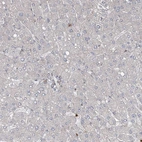 Immunohistochemical staining of human liver shows no positivity in hepatocytes as expected.