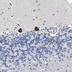 Anti-TMEM63C Antibody