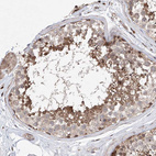 Anti-LACE1 Antibody