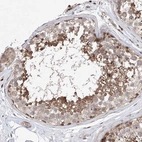 Anti-LACE1 Antibody