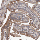 Immunohistochemical staining of human duodenum shows moderate granular cytoplasmic positivity in glandular cells.