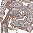 Immunohistochemical staining of human duodenum shows moderate granular cytoplasmic positivity in glandular cells.