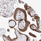 Immunohistochemical staining of human placenta shows moderate granular cytoplasmic positivity in trophoblastic cells.