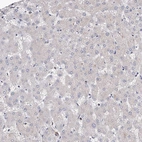 Immunohistochemical staining of human liver shows no positivity in hepatocytes as expected.