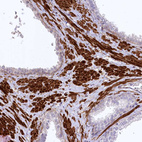 Immunohistochemical staining of human prostate shows strong cytoplasmic positivity in smooth muscle cells.