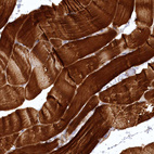 Immunohistochemical staining of human skeletal muscle shows strong cytoplasmic positivity in myocytes.