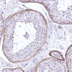 Immunohistochemical staining of human testis shows moderate cytoplasmic positivity in peritubular myoid cells.