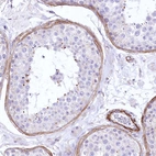 Immunohistochemical staining of human testis shows moderate cytoplasmic positivity in peritubular myoid cells.