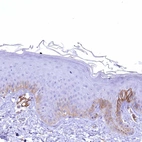Immunohistochemical staining of human skin shows weak cytoplasmic positivity in a subset of squamous epithelial cells.