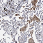 Immunohistochemical staining of human Lung shows moderate membranous and cytoplasmic positivity in pneumocytes.