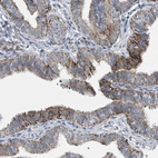 Immunohistochemical staining of human Fallopian tube shows moderate membranous positivity in glandular cells.