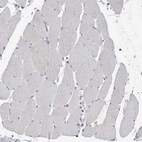 Immunohistochemical staining of human Skeletal muscle shows no positivity in myocytes as expected.