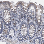 Immunohistochemical staining of human colon shows moderate membranous positivity in lymphoid cells.