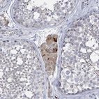 Immunohistochemical staining of human testis shows moderate cytoplasmic positivity in Leydig cells.