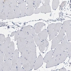 Immunohistochemical staining of human skeletal muscle shows no positivity in myocytes as expected.