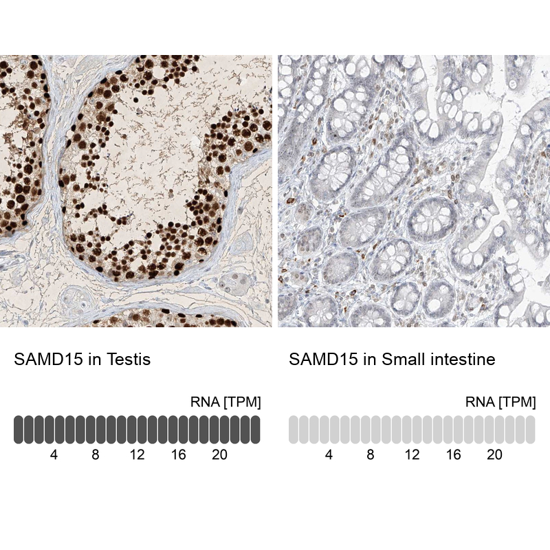 Anti-SAMD15 Antibody