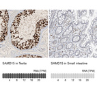 Anti-SAMD15 Antibody