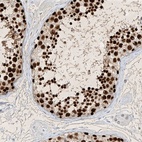 Anti-SAMD15 Antibody