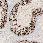 Immunohistochemical staining of human testis shows high expression.