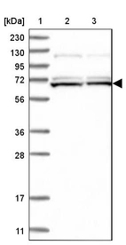 Lane 1: Marker [kDa] 230, 130, 95, 72, 56, 36, 28, 17, 11_br/_Lane 2: Human cell line RT-4_br/_Lane 3: Human cell line U-251MG sp