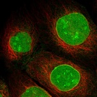 Anti-SAMD15 Antibody