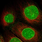 Immunofluorescent staining of human cell line A-431 shows localization to nucleus, nucleoli & nuclear membrane.