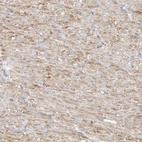Anti-MIPEP Antibody