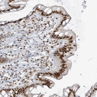 Anti-SAMD15 Antibody