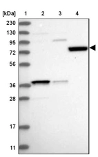 Lane 1: Marker [kDa] 230, 130, 95, 72, 56, 36, 28, 17, 11_br/_Lane 2: Human cell line RT-4_br/_Lane 3: Human cell line U-251MG sp_br/_Lane 4: Human plasma (IgG/HSA depleted)