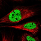Immunofluorescent staining of human cell line U-2 OS shows localization to nucleoplasm.