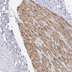 Immunohistochemical staining of human heart muscle shows high expression.