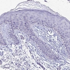 Immunohistochemical staining of human skin shows low expression as expected.