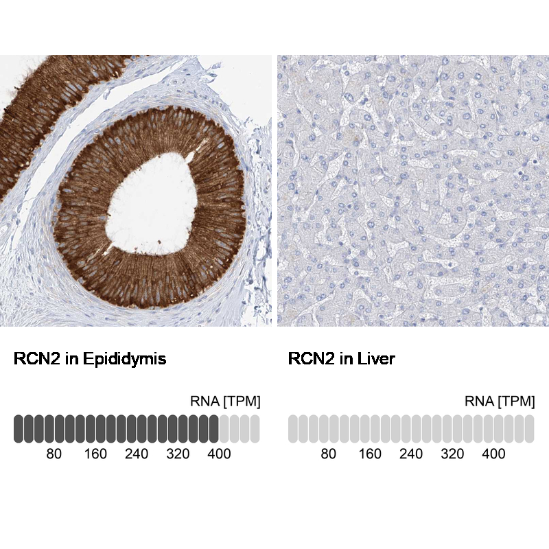 Anti-RCN2 Antibody