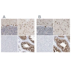 Immunohistochemical staining of human cerebellum, cerebral cortex, liver and testis using Anti-RCN2 antibody HPA030694 (A) shows similar protein distribution across tissues to independent antibody HPA030695 (B).