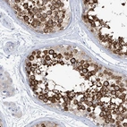 Immunohistochemical staining of human testis shows strong cytoplasmic positivity in cells in seminiferous ducts.