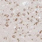 Immunohistochemical staining of human cerebral cortex shows strong cytoplasmic positivity in neurons.