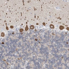 Immunohistochemical staining of human cerebellum shows strong cytoplasmic positivity in Purkinje cells.