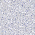 Anti-RCN2 Antibody