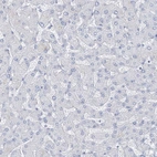 Immunohistochemical staining of human liver shows no positivity in hepatocytes as expected.