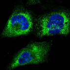 Immunofluorescent staining of human cell line U-251 MG shows localization to endoplasmic reticulum.
