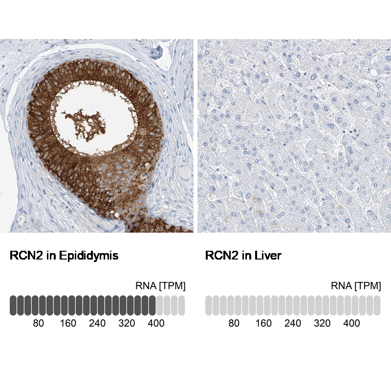 Anti-RCN2 Antibody