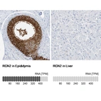 Anti-RCN2 Antibody