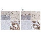 Immunohistochemical staining of human cerebellum, cerebral cortex, liver and testis using Anti-RCN2 antibody HPA030695 (A) shows similar protein distribution across tissues to independent antibody HPA030694 (B).