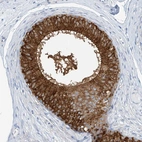 Immunohistochemical staining of human epididymis shows strong cytoplasmic positivity in glandular cells.