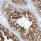 Immunohistochemical staining of human testis shows strong cytoplasmic positivity in cells in seminiferous ducts.