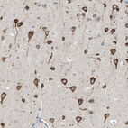 Immunohistochemical staining of human cerebral cortex shows strong cytoplasmic positivity in neurons.
